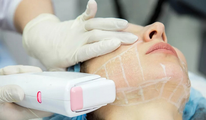 Пилинг лица. Ultra Подарки Владимир. Подарочный сертификат на натуральную пилинг лица. Ultra Подарки Владимир. 8 800-505-9503. Пилинг лица  #вМоскве#, чистка лица, очищение лица, химический пилинг